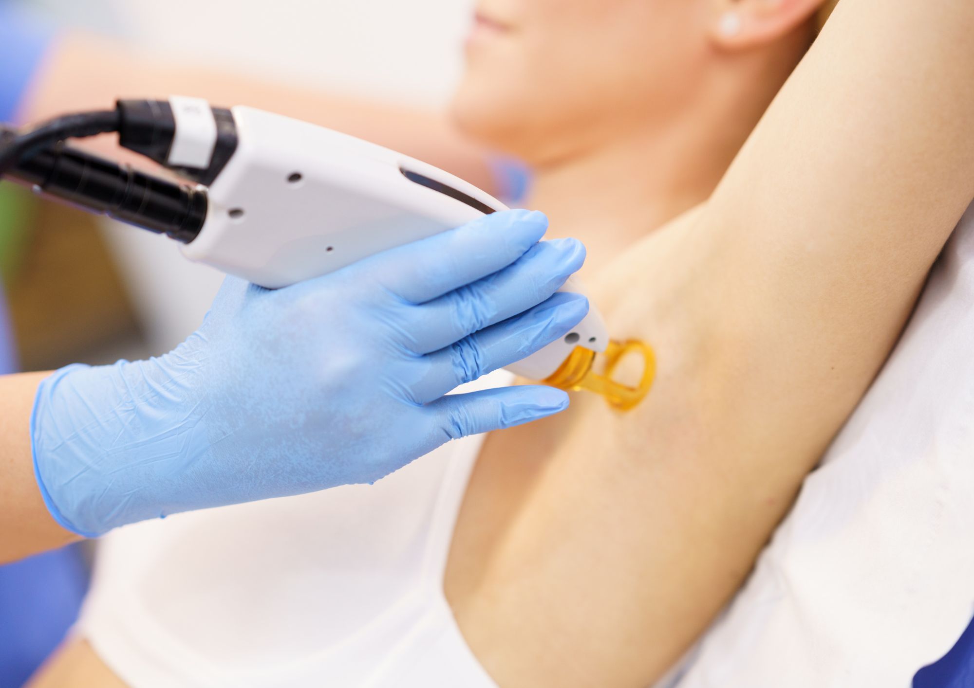 מאיזה גיל אפשר לעשות לייזר